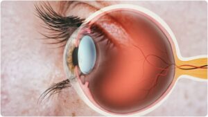 Kgmu:केजीएमयू ने 10 रुपये की लागत से 3डी कृत्रिम आंख बनाई, क्रांतिकारी उपलब्धि हासिल की – Kgmu: Kgmu Makes 3d Prosthetic Eye At A Cost Of Rs 10, Achieves Revolutionary Achievement