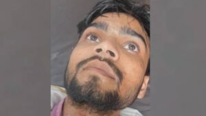 Lucknow :चाइनीज मांझे से भाजपा नेता का गला कटा, तीन टांके लगे, राजस्व निरीक्षक भी हुए घायल – Lucknow: Bjp Leader’s Throat Slit With Chinese Thread In Kakori, Three Stitches Required