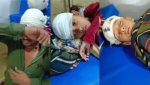 उरई में आंधी का कहर:सोते हुए परिवार पर गिरा टीन शेड, पति और तीन बच्चे गंभीर रूप से घायल, अस्पताल में भर्ती – Storm Wreaks Havoc In Orai Tin Shed Collapses On Sleeping Family Husband And Three Children Critically Injured