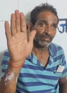 Jalaun News: महिला और किसान पर सियार का हमला, घायल